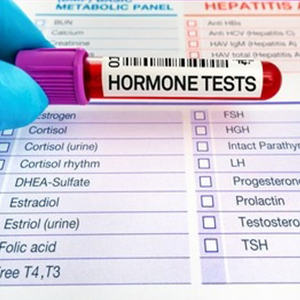 Hormonal Assay Test in Vijayawada